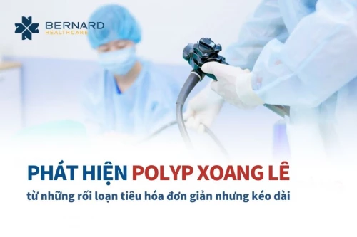 Bệnh nhân polyp xoang lê: Phát hiện từ những rối loạn tiêu hóa tưởng chừng đơn giản nhưng kéo dài